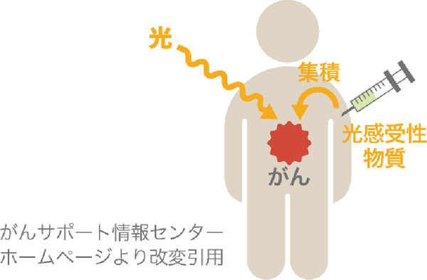 医科では早期がんの治療法として